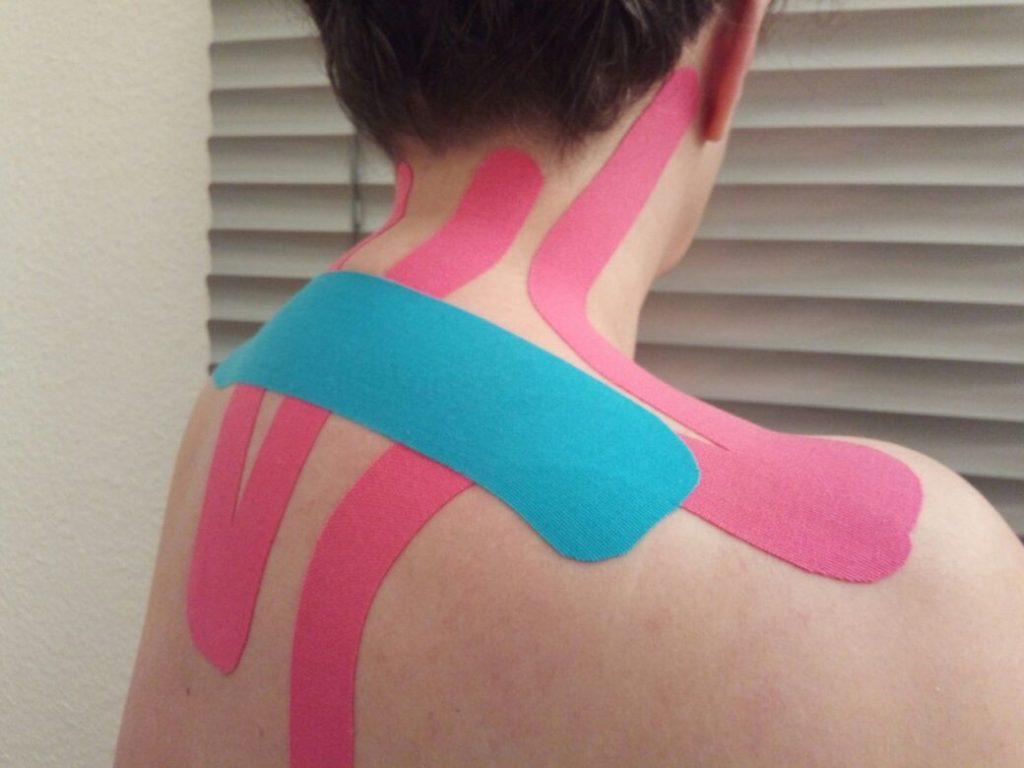Kinesiotaping zur Linderung von Schmerzen im Rücken- und Nackenbereich